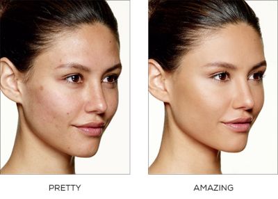 bare minerals good for acne